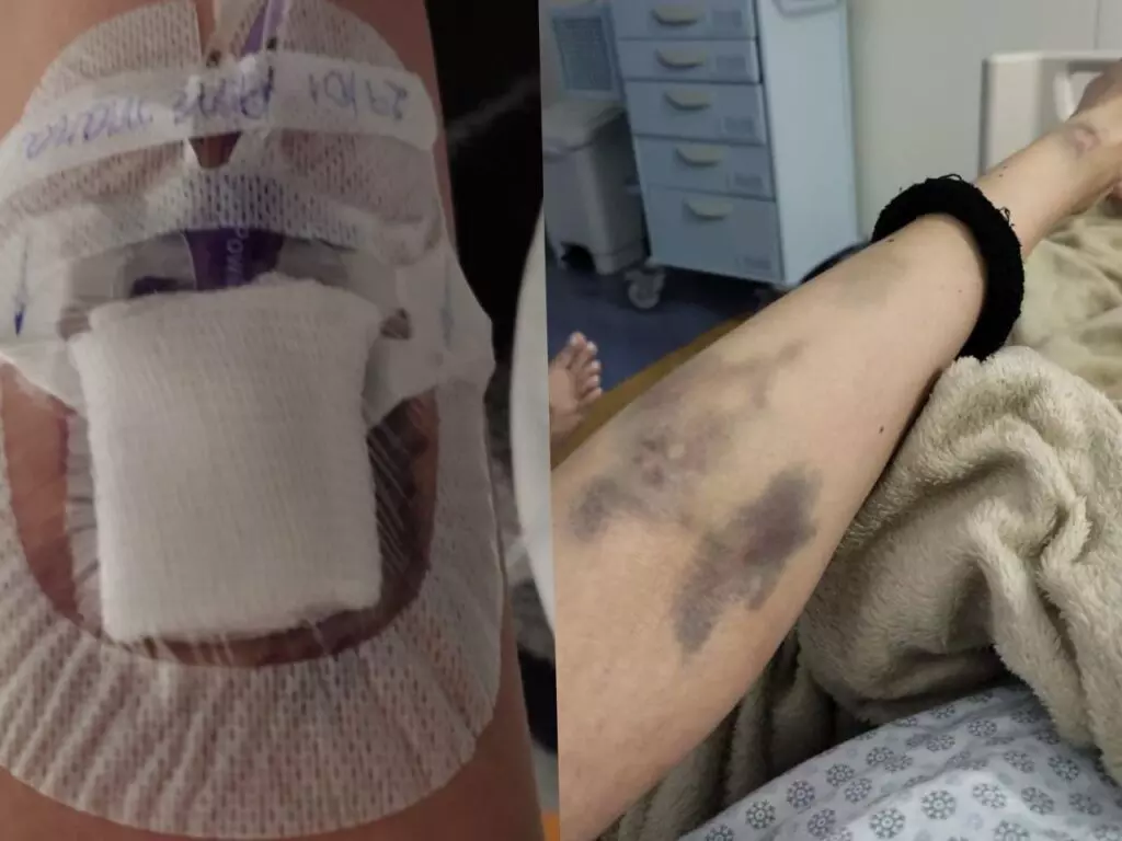 Ex-residente em Corumbá, Jovem com Doença Rara Lutou na Justiça por Medicação de R$ 40 Mil