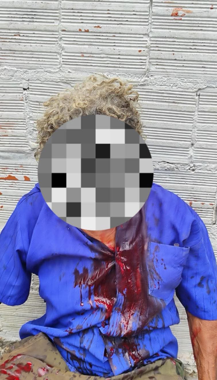 Homem sofre ataque brutal de pitbull em Corumbá e fica gravemente ferido no rosto