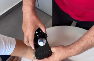 Telemedicina em Dermatologia: Avanços no Diagnóstico de Câncer de Pele no Mato Grosso do Sul